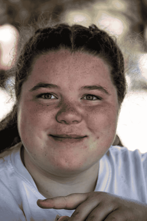 Why Would a Teen Need Semaglutide